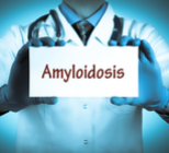 עמילואידוזיס - תמונת המחשה